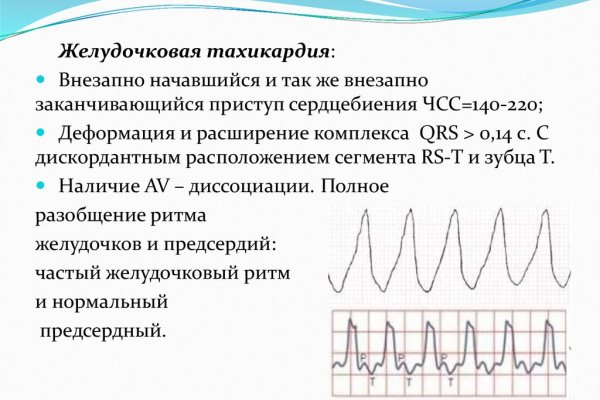 Омг